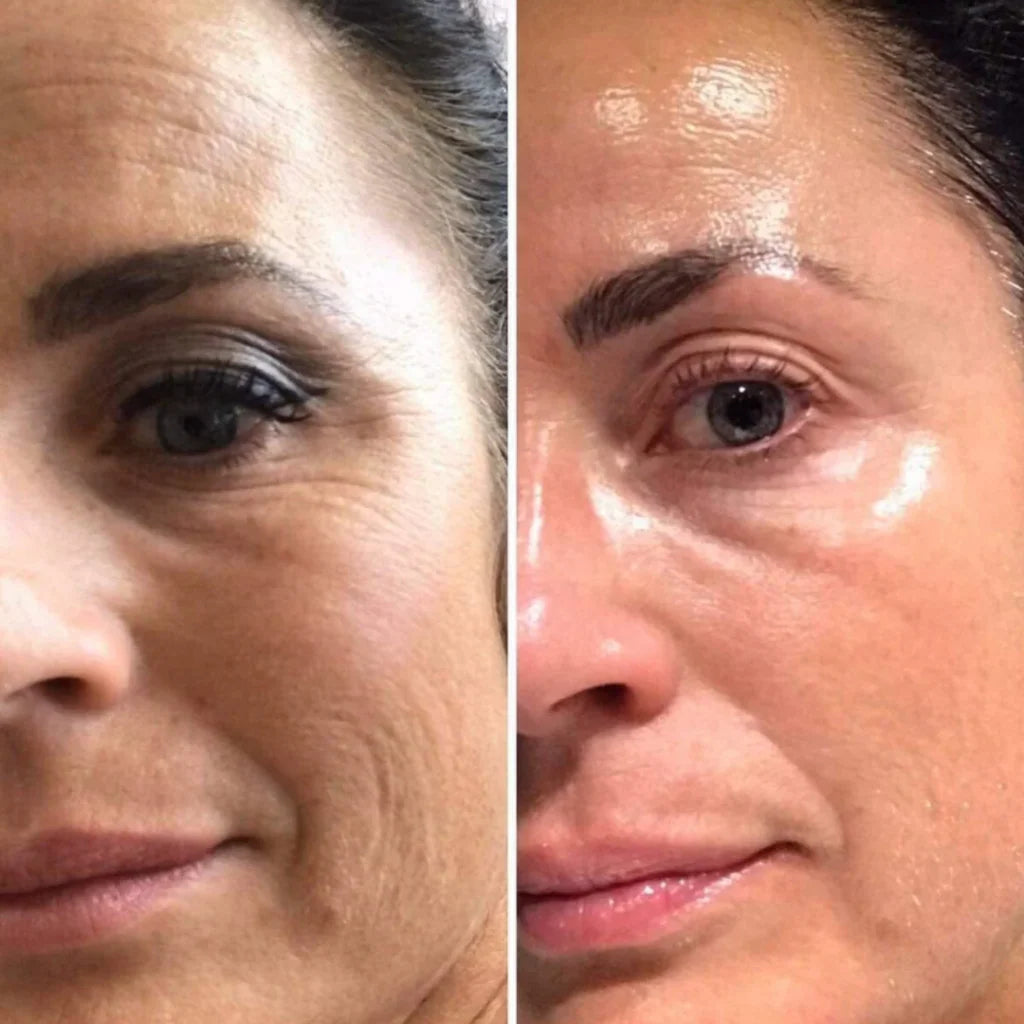 RETINAL SHOT CELIMAX: Para Quienes Buscan Una Piel Impecable 🧬
