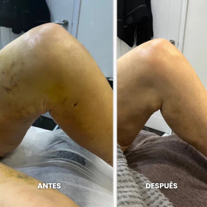 Lymphatic Drainage: Libera Los Líquidos Que Tu Cuerpo Ya No Necesita. 🧘🏻