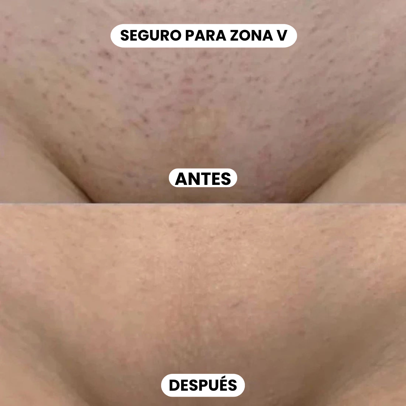 CYPERUS ROTUNDUS OIL 60ml: Tratamiento natural anti vello sin irritación🪒💖