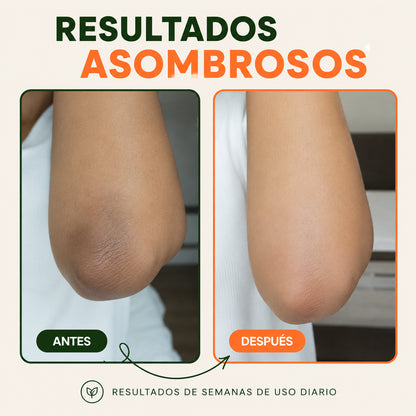Jiyu Skin Tone Pads™: Ilumina las zonas que más escondes ✨🧡
