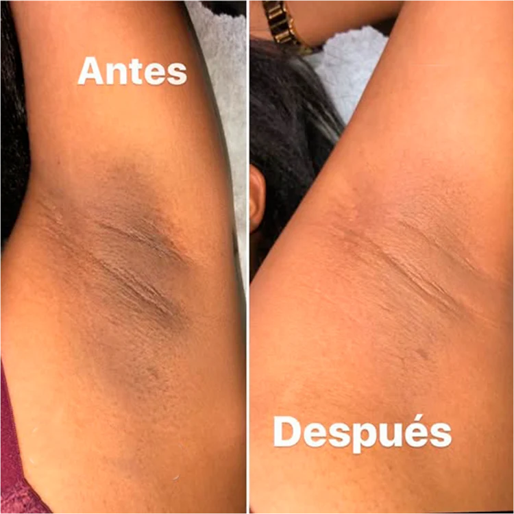 ¿Y SI DEJARAS DE OCULTAR TU PIEL? ✨