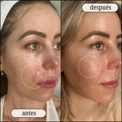 RETINAL SHOT CELIMAX: Para Quienes Buscan Una Piel Impecable 🧬